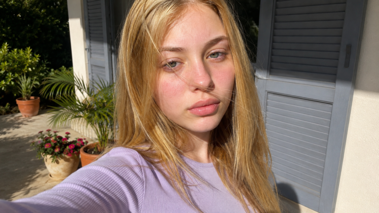 How to Remove Dark Circles Fast at Home (2026 Guide)