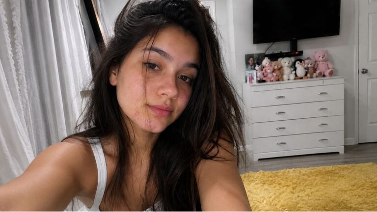Stop Doing This! It’s Making Your Acne Worse
