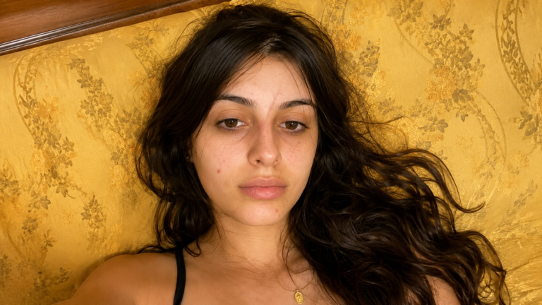 Why Your Acne Isn’t Going Away (Fix This First)