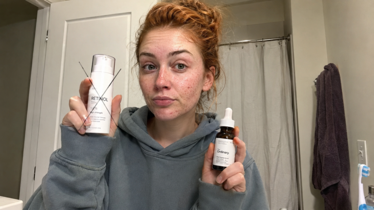 “I Stopped Using Retinol for 30 Days and Used Peptides Instead — Here’s What Actually Happened to My Acne”