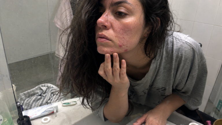 The Skin Barrier Blueprint: Is Your Skincare Routine Actually Ruining Your Skin? ⚠️